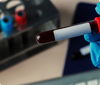 A person wearing blue gloves holds a blood sample in a tube.