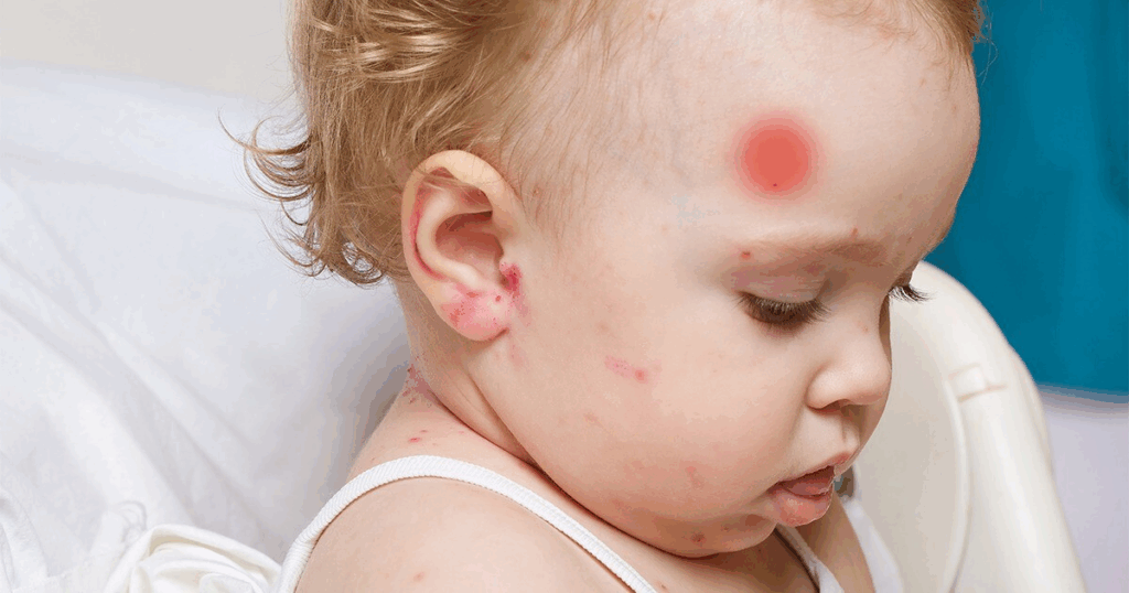 Toddler with visible head injury and red marks on skin, highlighting concern for toddler's head injury and related symptoms