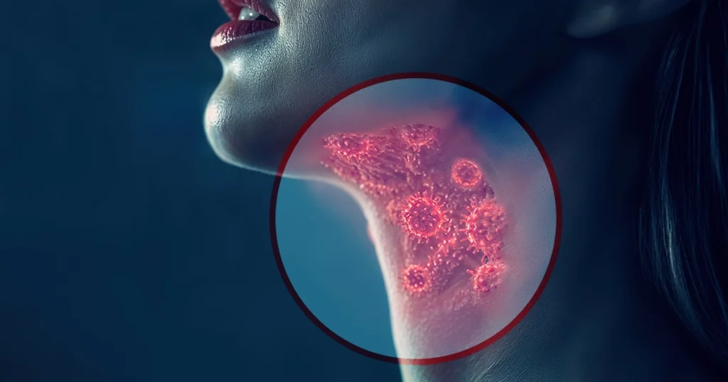 Illustration of throat infection with highlighted viruses in the neck.