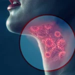 Illustration of throat infection with highlighted viruses in the neck.